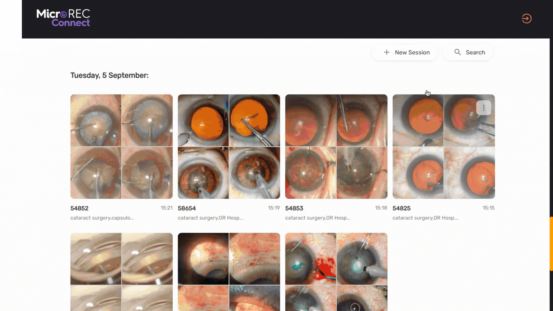 Organization of eye surgeries in different sessions with detailed information stored in a safe cloud