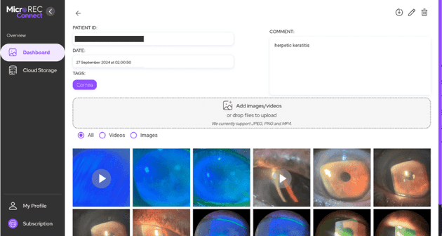 MicroREC Connect Platform for ophthalmologists